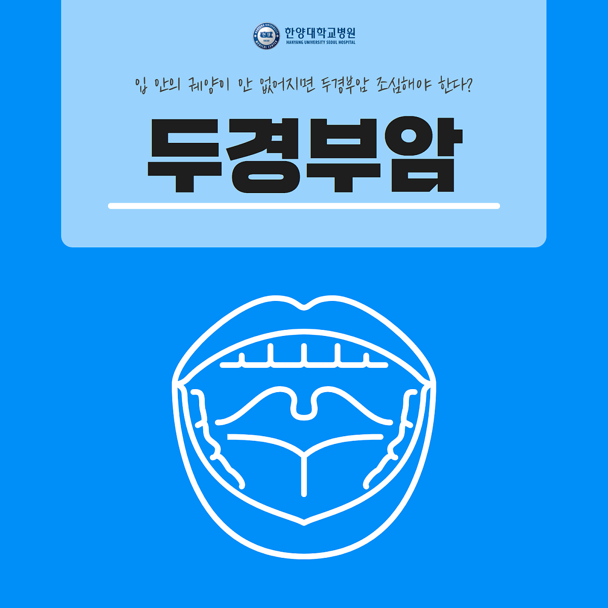 입안의 궤양이 안 없어지면 두경부암 조심해야 한다?